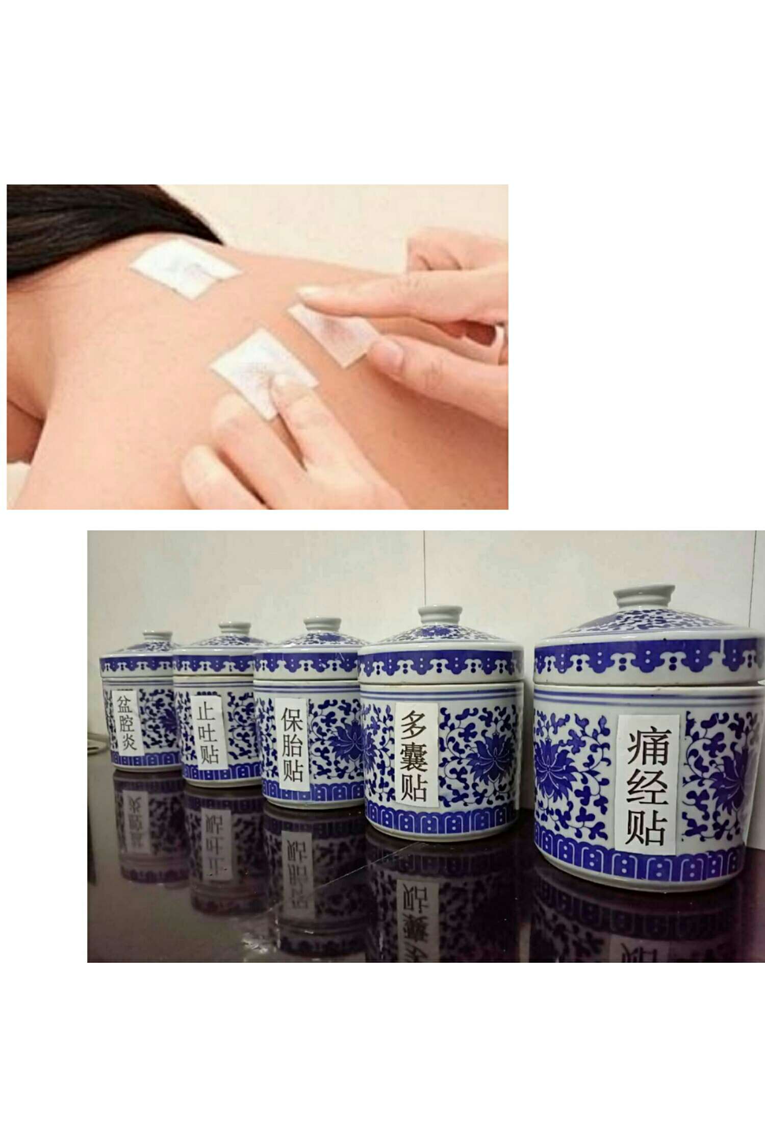 1、三伏貼能治什么?。? style=