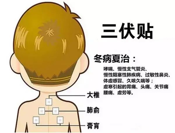 2、三伏貼的功能和功效是什么？