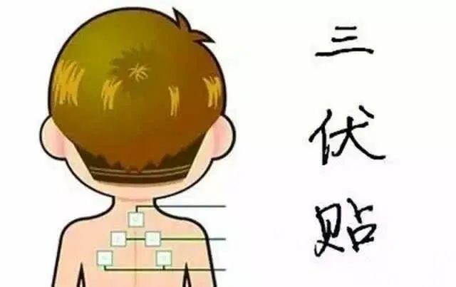 1、“兒童三伏貼”能讓孩子少生病嗎？爸爸媽媽不再盲目跟風了。