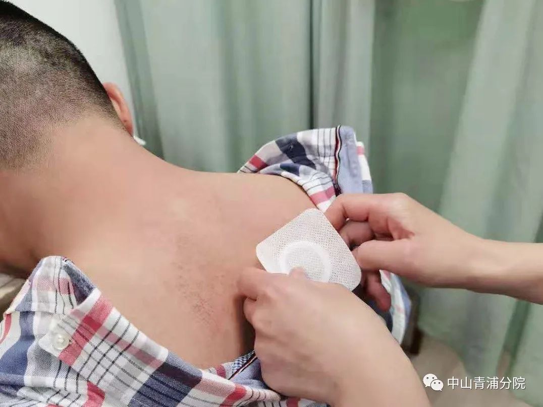 2、江西兒童貼三伏貼癢灼痛，什么體質(zhì)的人可以貼三伏貼癢灼痛？