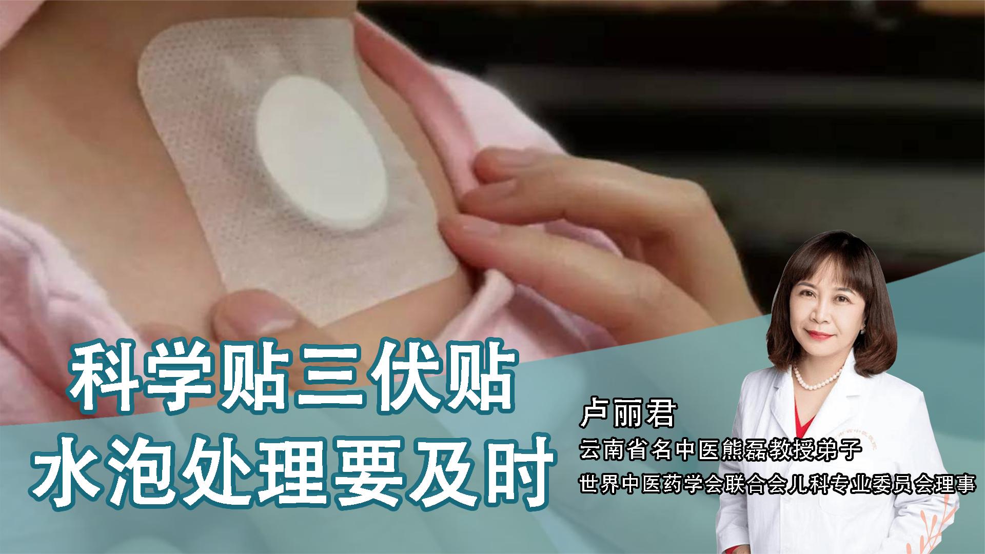 2、貼三伏貼后有什么禁忌？
