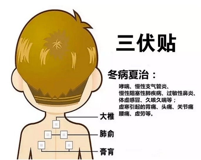 1、三伏貼多大？寶寶能貼多少？</p><p>三伏貼孩子貼多久？