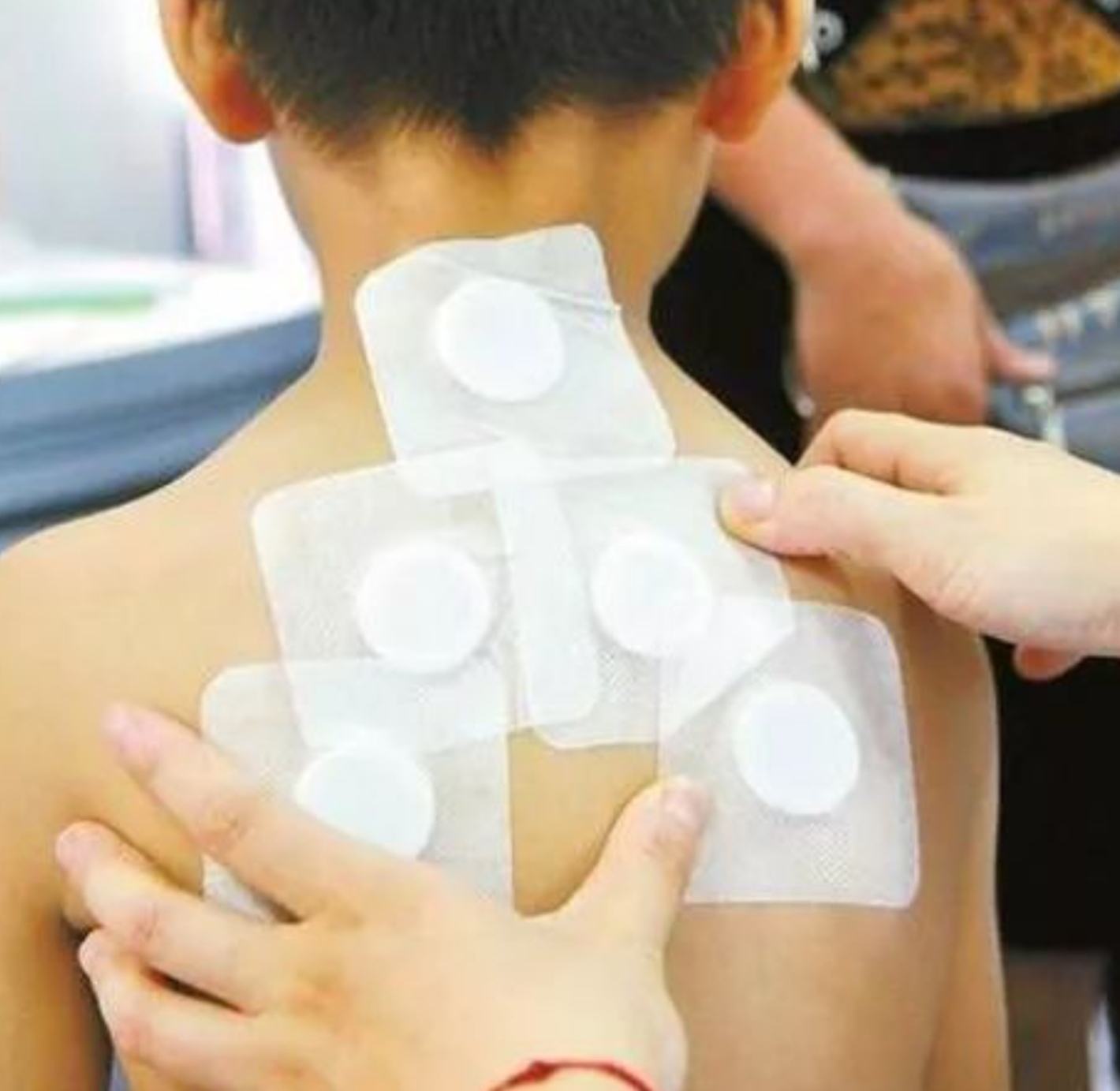 2、三伏貼在脖子上，有一根針，看起來(lái)很疼。怎么了